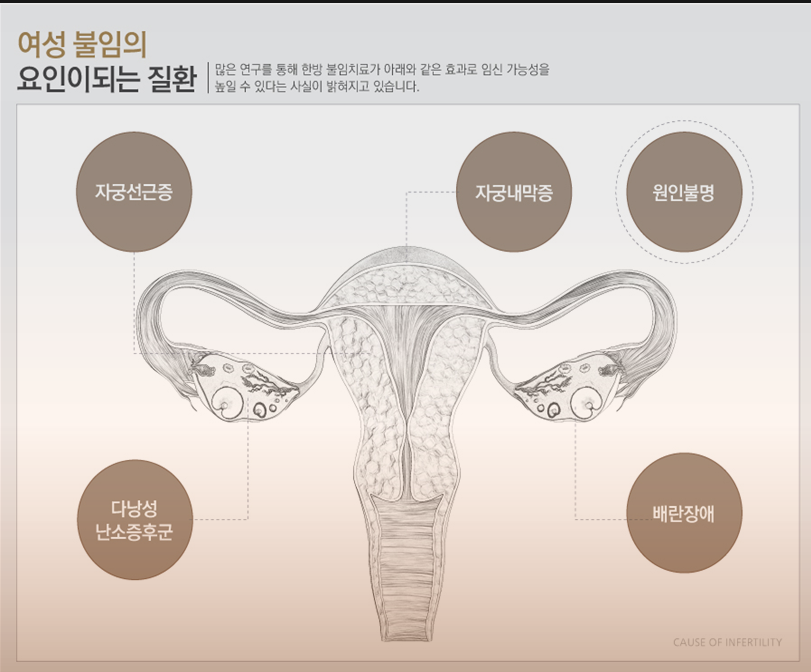 출산 후 발생되는 반복유산 (3)