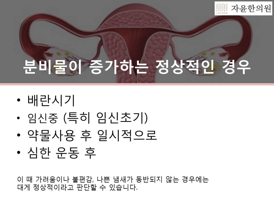 여성 질 분비물 증가하는 여러가지 원인알아보자! (3)