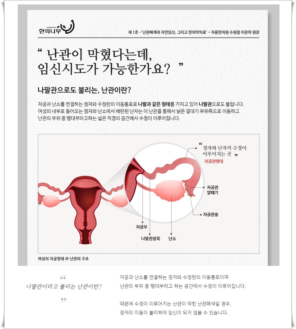 난관이 막혀있어요. 자연임신은 불가능 할까요? (2)