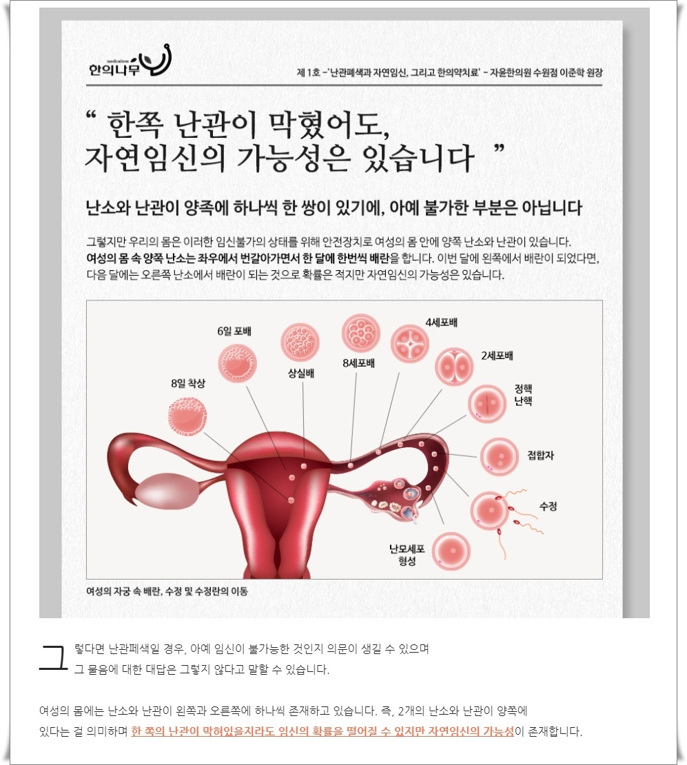 난관이 막혀있어요. 자연임신은 불가능 할까요? (3)