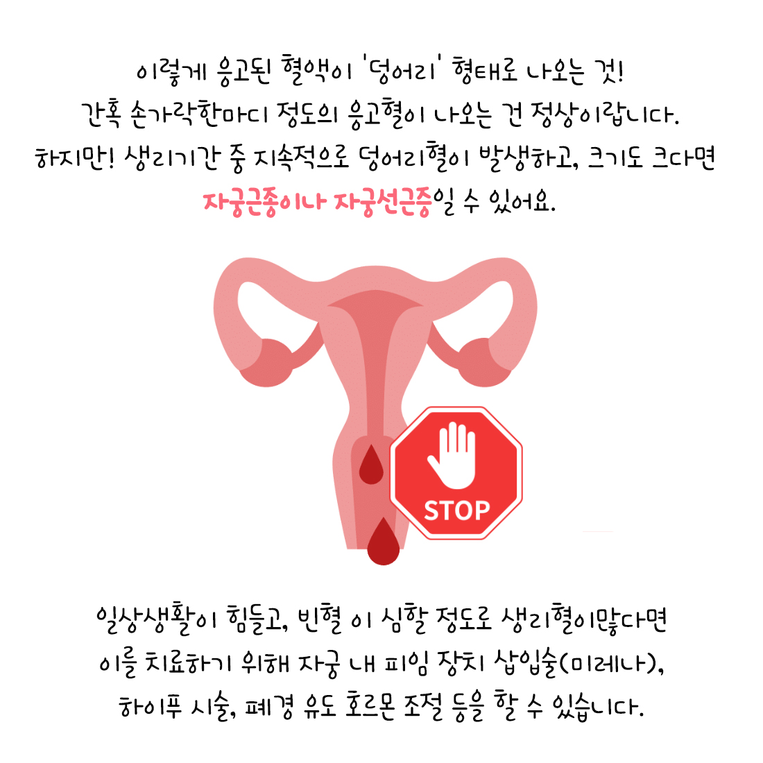 {자윤한의원 여성건강툰] 23화.생리 덩어리혈 나오는 이유 (4)