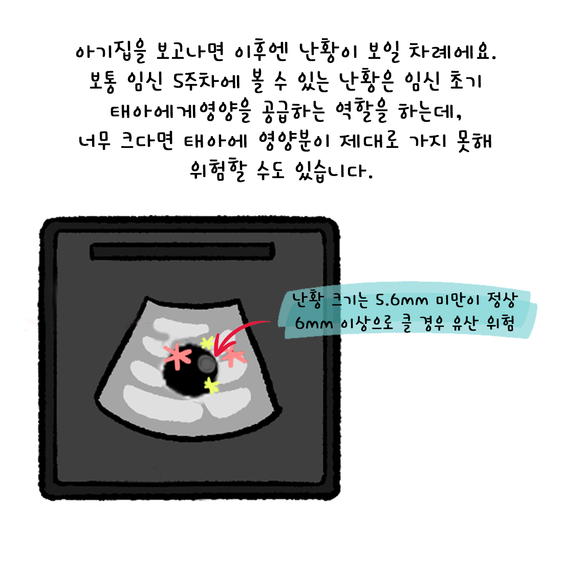 [자윤한의원 여성건강툰] 43화. 아기집은 언제 볼 수 있나요? 임신초기 임밍아웃은 언제? (5)
