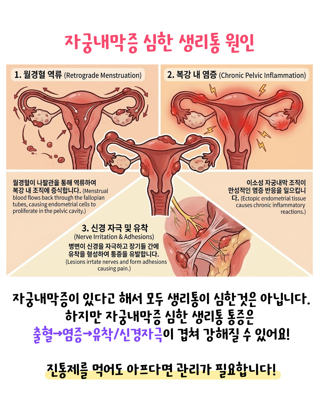[자윤한의원 여성건강툰]자궁내막증 심한 생리통 원인이 무엇일까? (4)